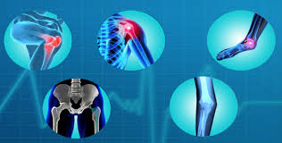 Orthopedics